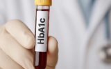 HbA1c Testi Nedir? Normal Değerler, Sıklık ve Diyabette Önemi