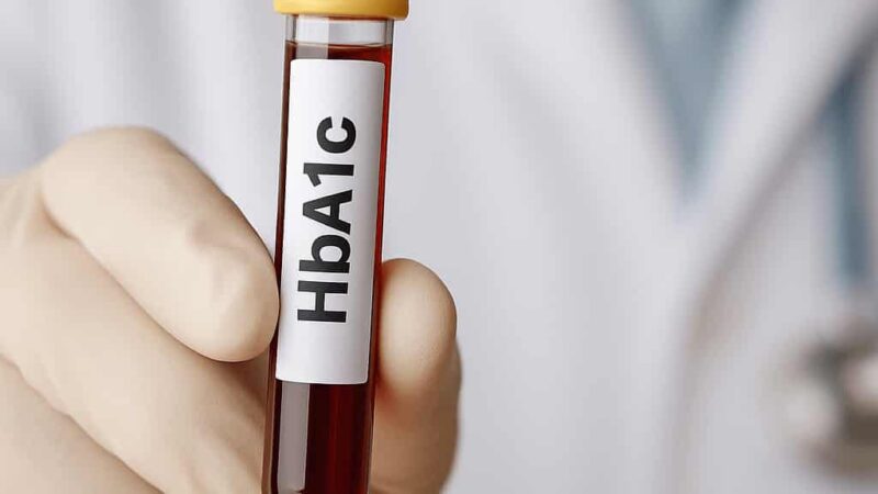 HbA1c Testi Nedir? Normal Değerler, Sıklık ve Diyabette Önemi